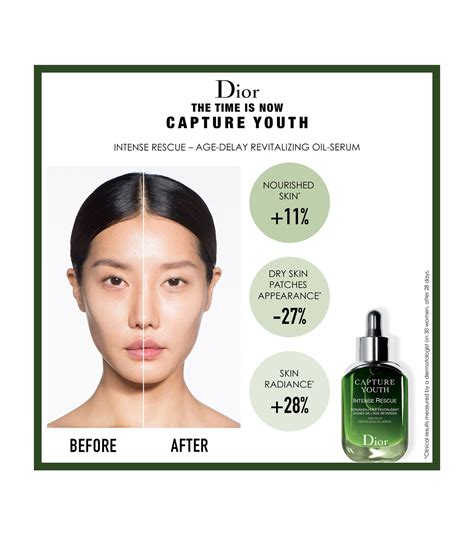 intense rescue dior review|Dior Capture Youth Intense Rescue Revitalizing Oil Serum 30ml.